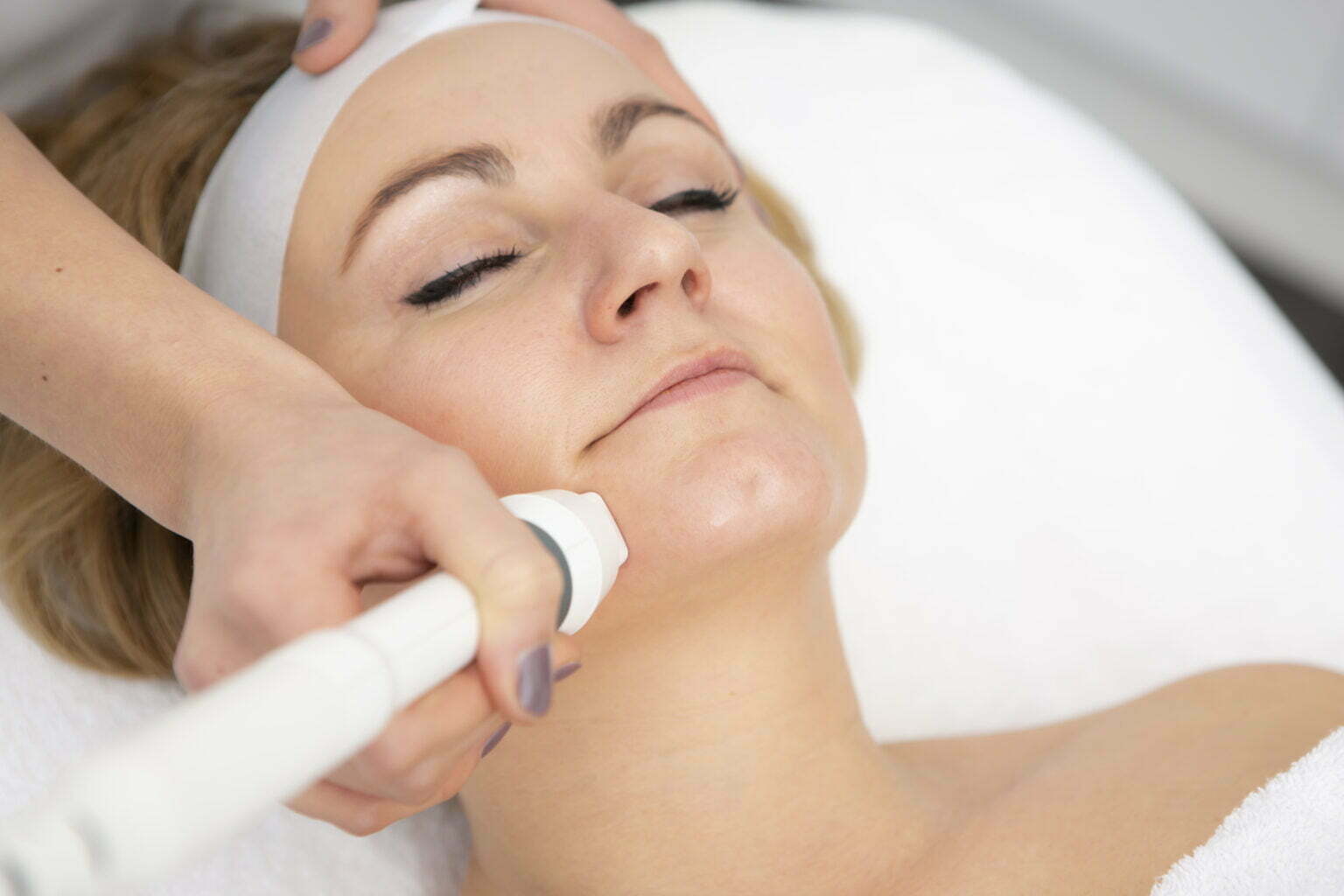 Dit kan je doen tegen Rimpels rond de mond - Mooiinstituut