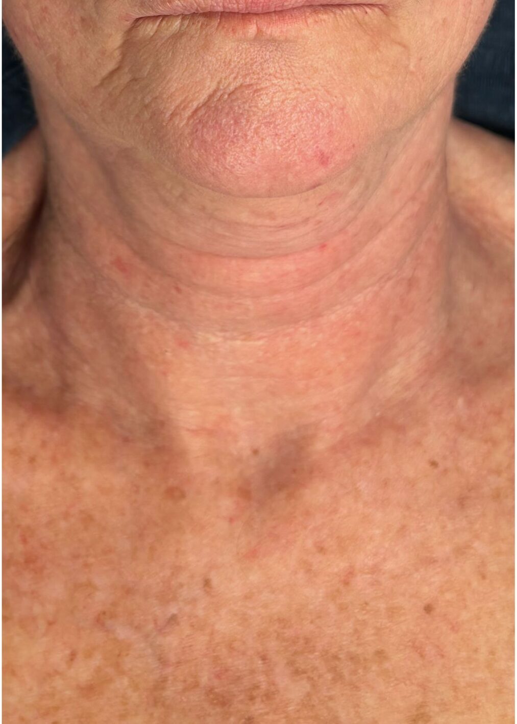 Before image alt