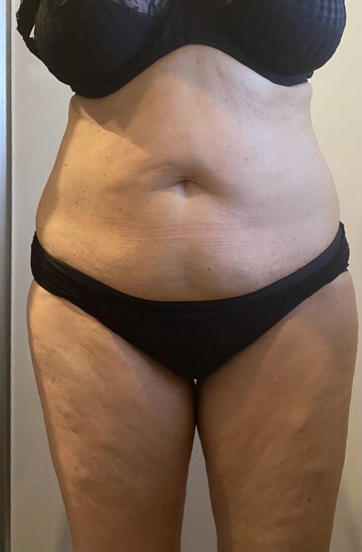 Before image alt
