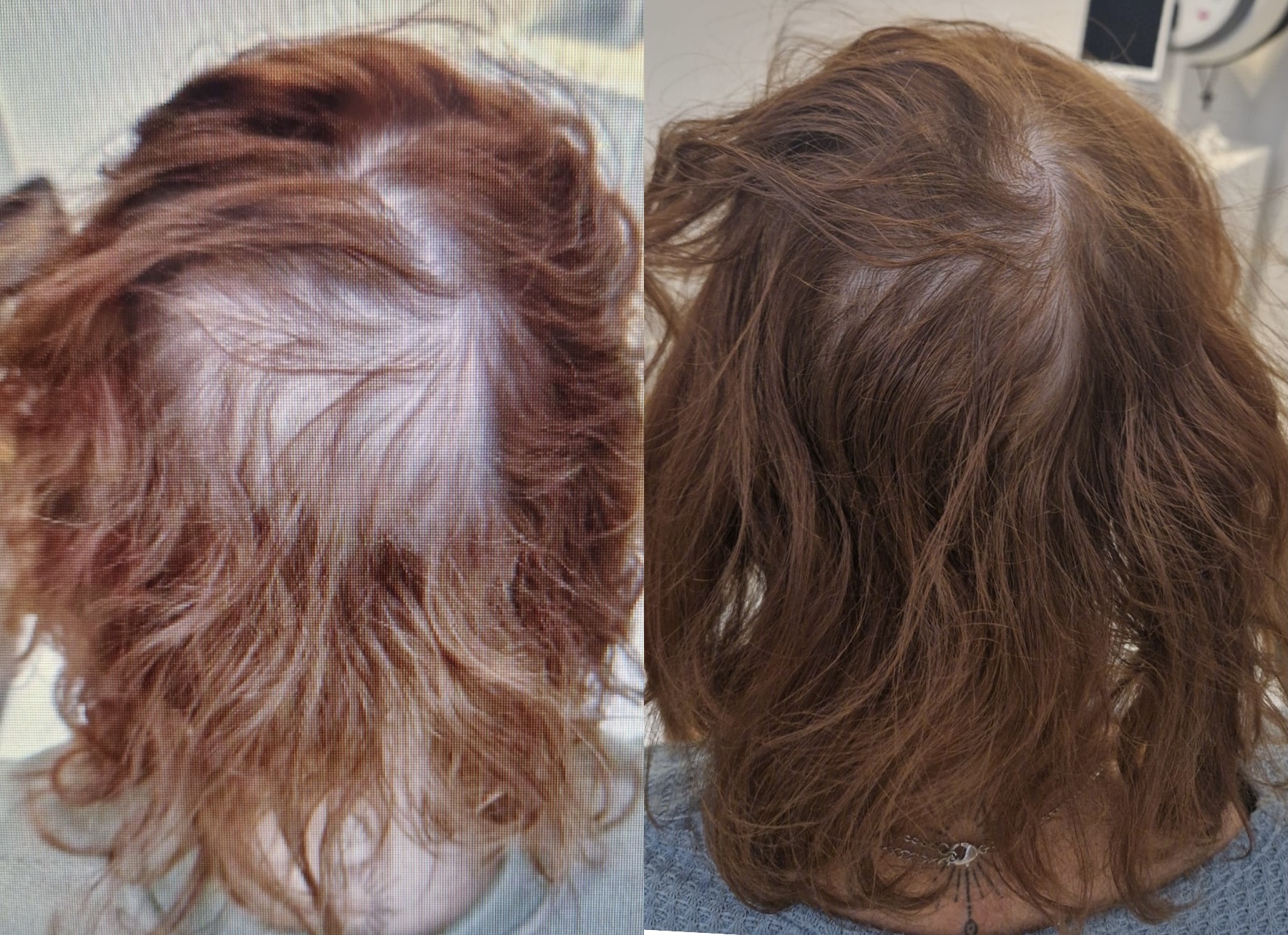 Voor en na behandeling - voller haar bij Mooi Instituut Zevenbergen
