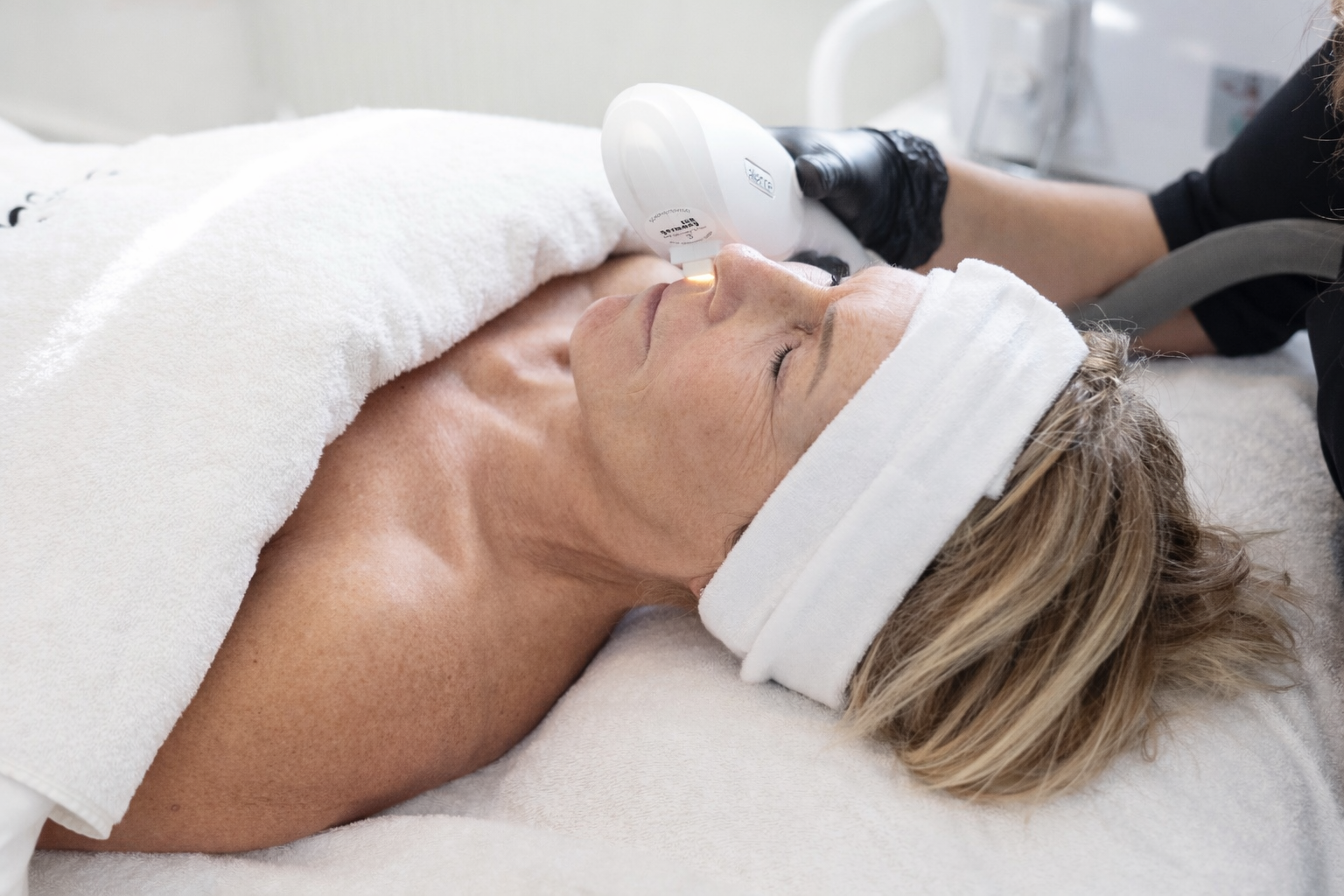 Laser ontharing behandeling Mooi Instituut Zevenbergen