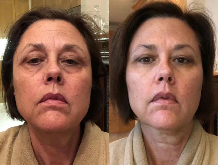 Eindelijk, skincare dat werkt